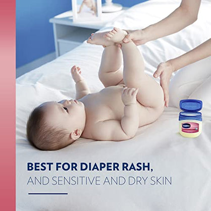 Vaseline, 100% Pure Petroleum Jelly Baby, Dermatologist Recommended, Hypoallergenic, Skin Protectant, Treat & Prevent Diaper Rash and Chafed Skin, Seals out Wetness, 13 Ounce (Pack of 2 )