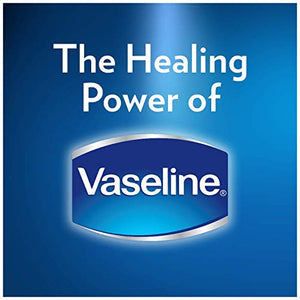Vaseline Lip Therapy | Vaseline Lip Balm | Lip Moisturizer for Very Dry Lips | Aloe | 20g